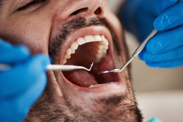 Best Urgent Tooth Repair  in Dawson, TX